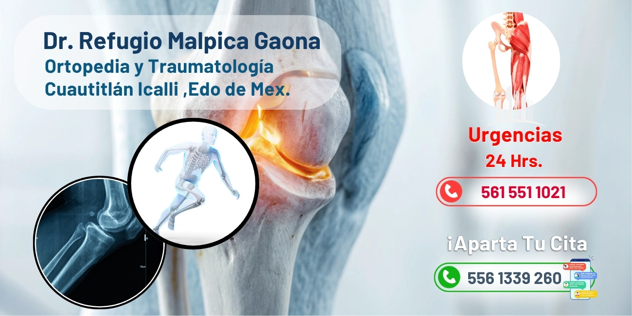 Refugio Malpica Gaona-Cuautitlán Izcalli